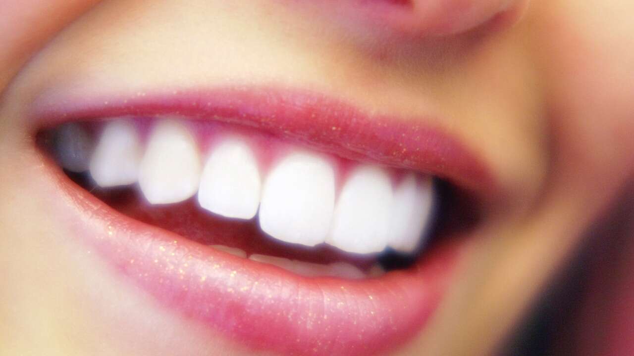 Dientes amarillentos: seis alternativas naturales para el blanqueamiento dental sin dañar el esmalte