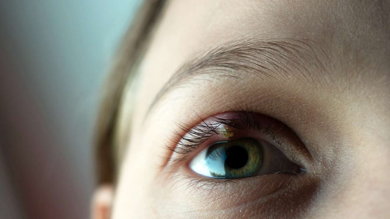 Así debes limpiarte los ojos para evitar orzuelos, conjuntivitis o úlceras y mejorar tu higiene