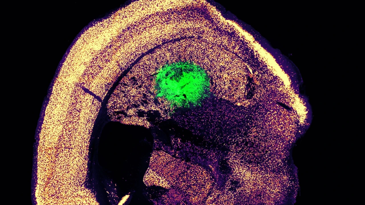 Científicos del MIT transforman células de la piel en neuronas
