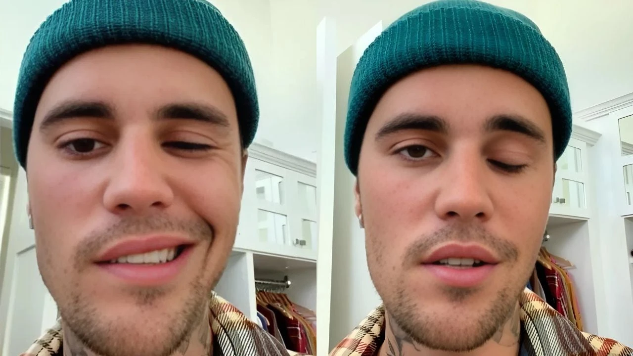 Qué es el síndrome de Ramsay Hunt, la enfermedad que paralizó la cara de Justin Bieber