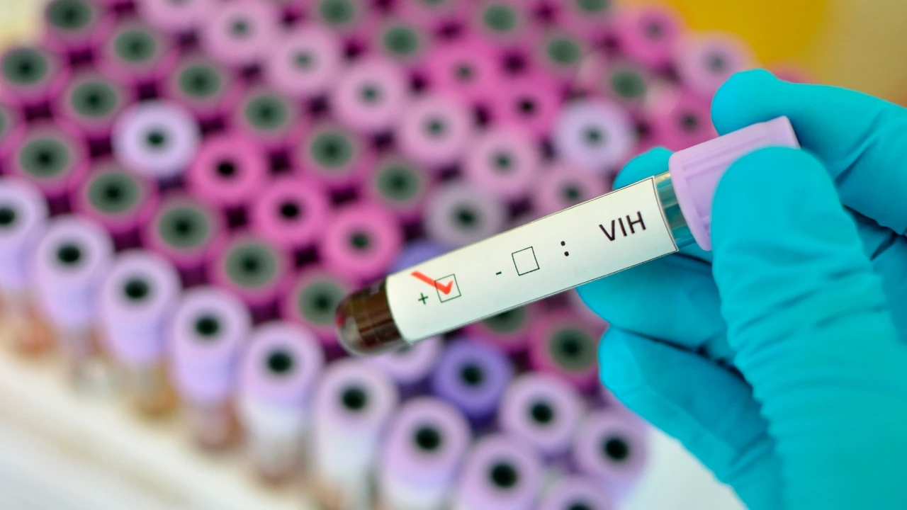 Denuncian que el estigma asociado al sida sigue presente entre los sanitarios