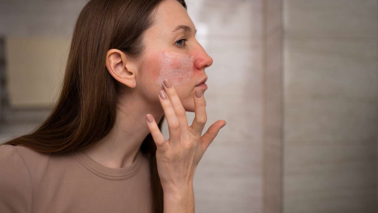 Descubren la primera pomada que reduce las manchas y erupciones rojas del lupus