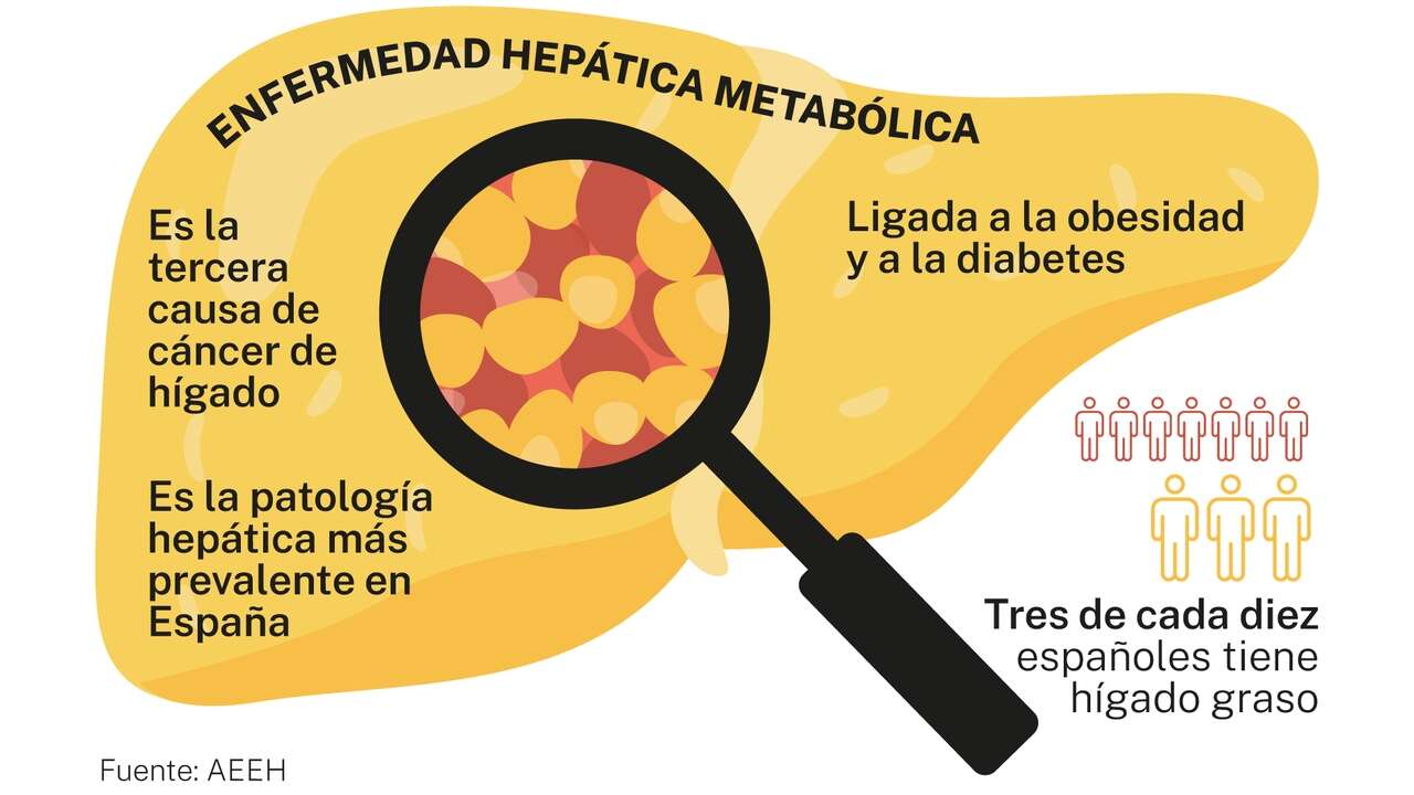 El hígado graso se dispara entre los jóvenes y esta es la dieta que lo revierte