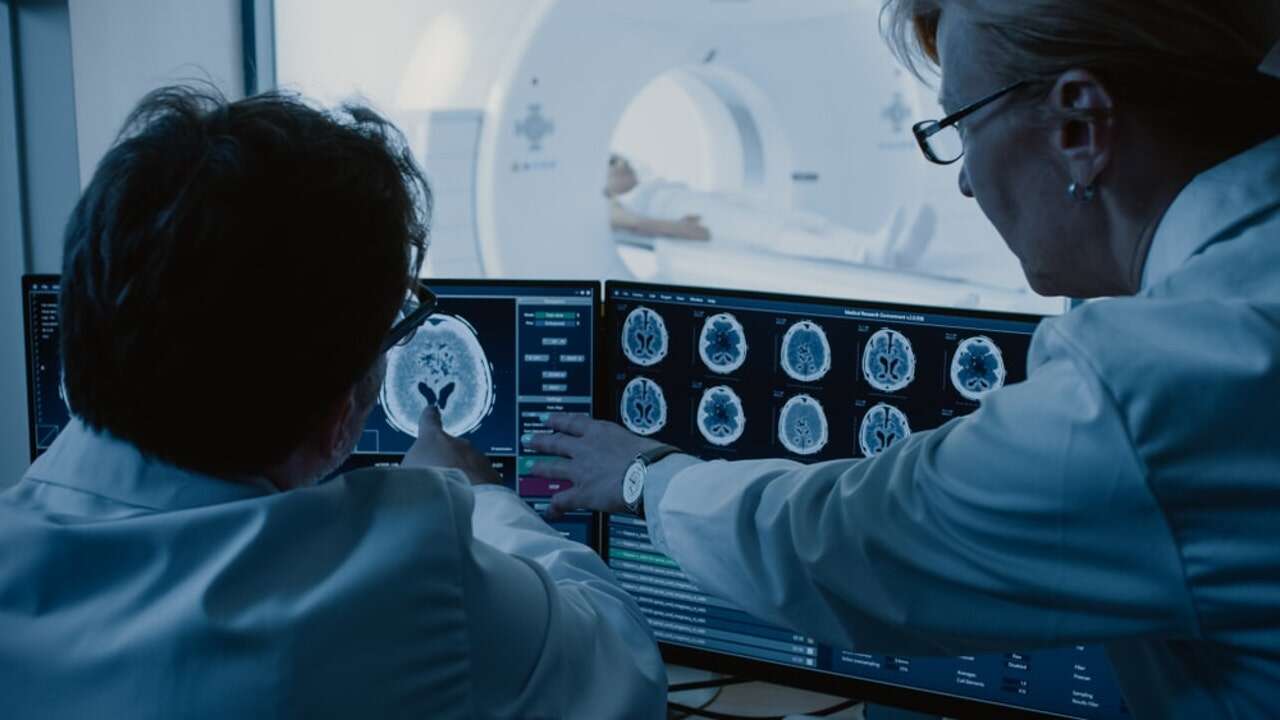 Glicoingeniería para esclerosis múltiple