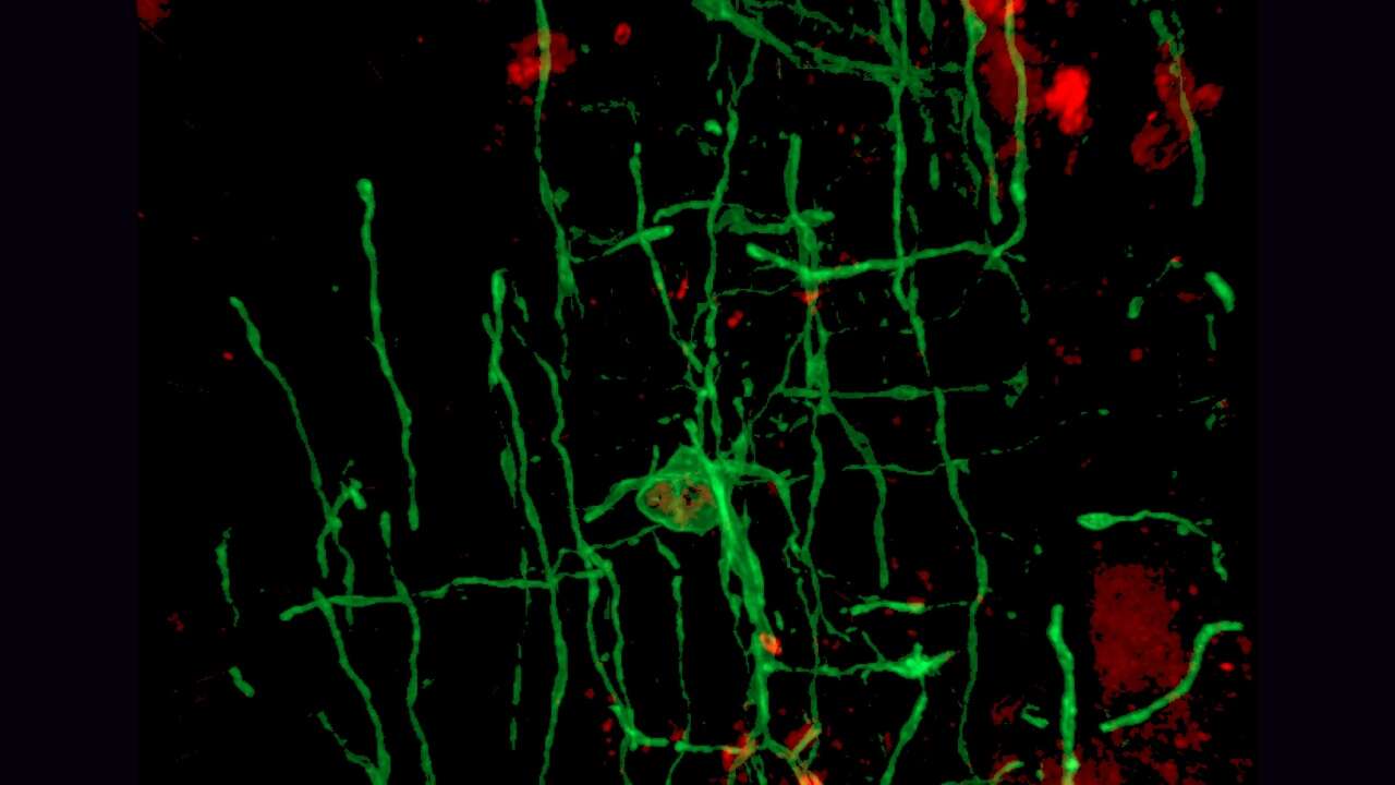 Nuestro cerebro es posible por un virus que infectó a nuestros antepasados