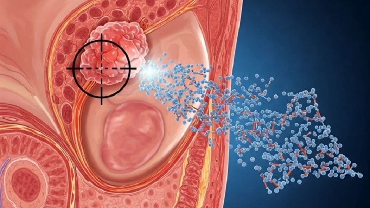 Científicos españoles crean unas nanopartículas capaces de llegar a los tumores de próstata para erradicar las células tumorales