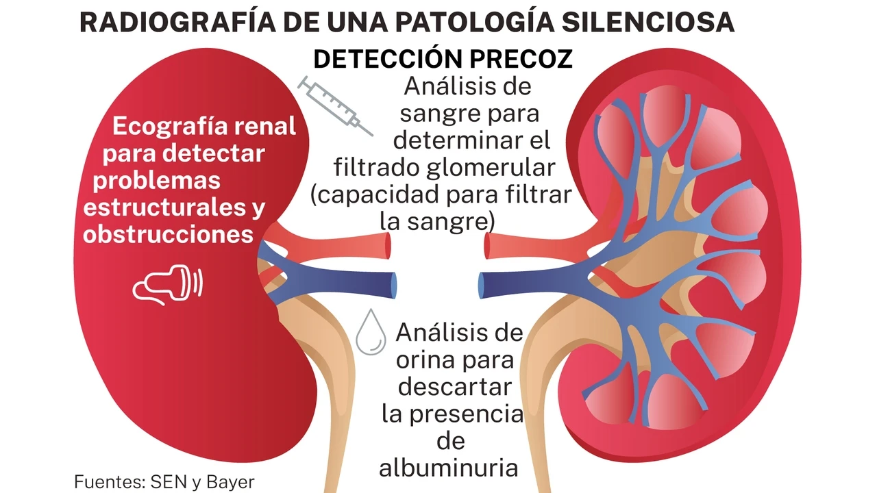 Medir la albúmina en orina frena la enfermedad renal crónica
