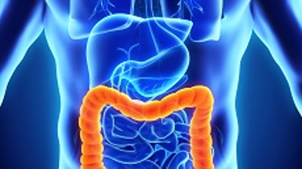 Duplican la supervivencia en cáncer de colon metastásico gracias a una nueva estrategia terapéutica