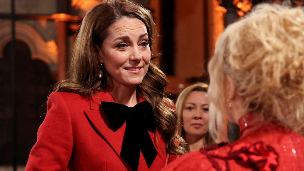 La cicatriz de Kate Middleton que desvela otra operación secreta: 