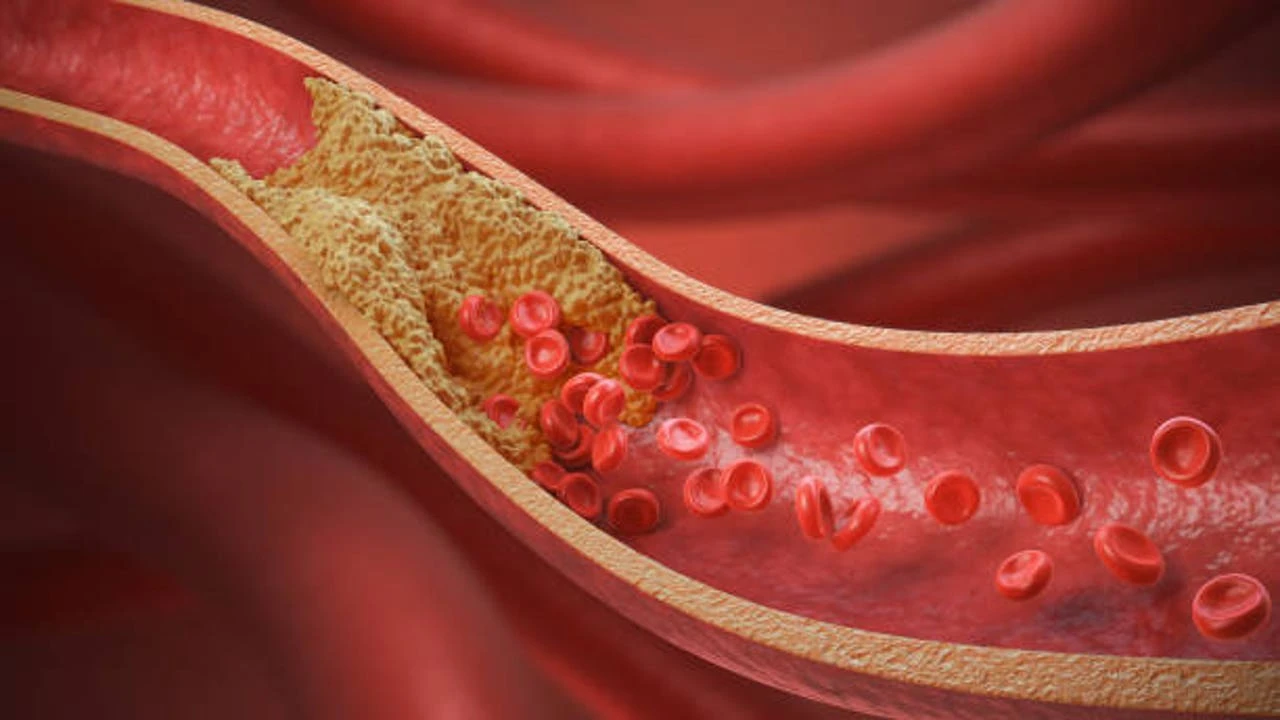 Cardiólogo comparte una de las maneras más efectivas para bajar el colesterol: 