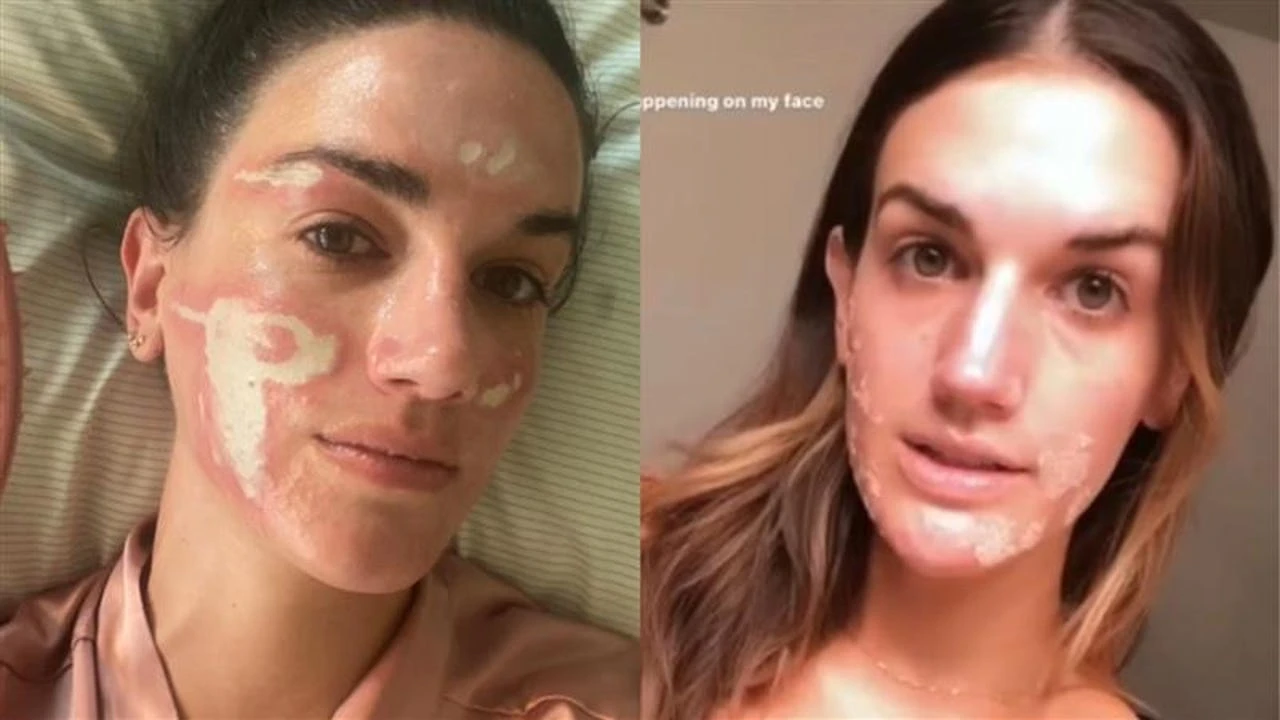 Una mujer acusa a la esteticista de Kim Kardashian, Jennifer López o Madonna: 