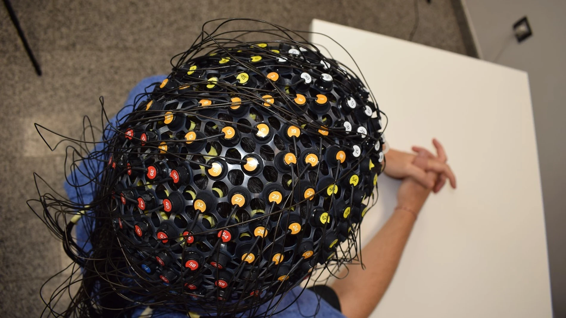 Investigadores españoles desarrollan una nueva vía para tratar enfermedades neurológicas como el ictus o la enfermedad de Parkinson sin necesidad de cirugía