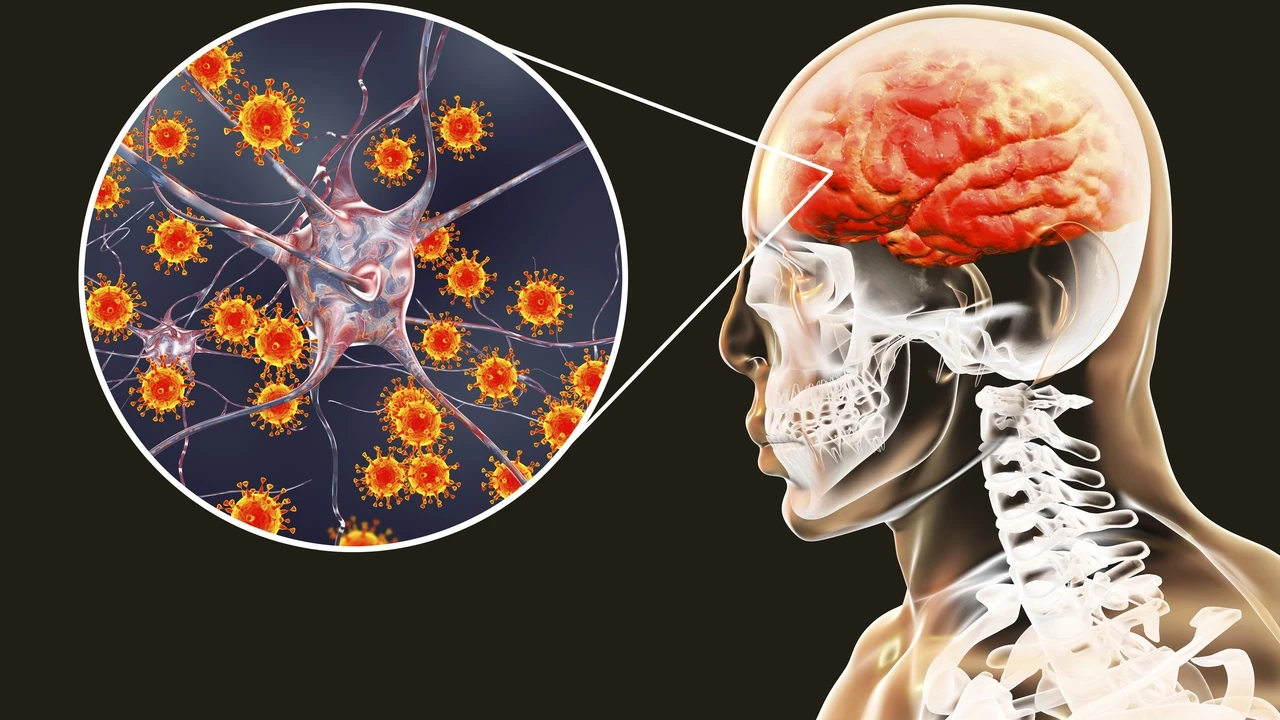 La meningitis aumenta en España: cómo prevenir la enfermedad que puede causar la muerte en cuestión de horas