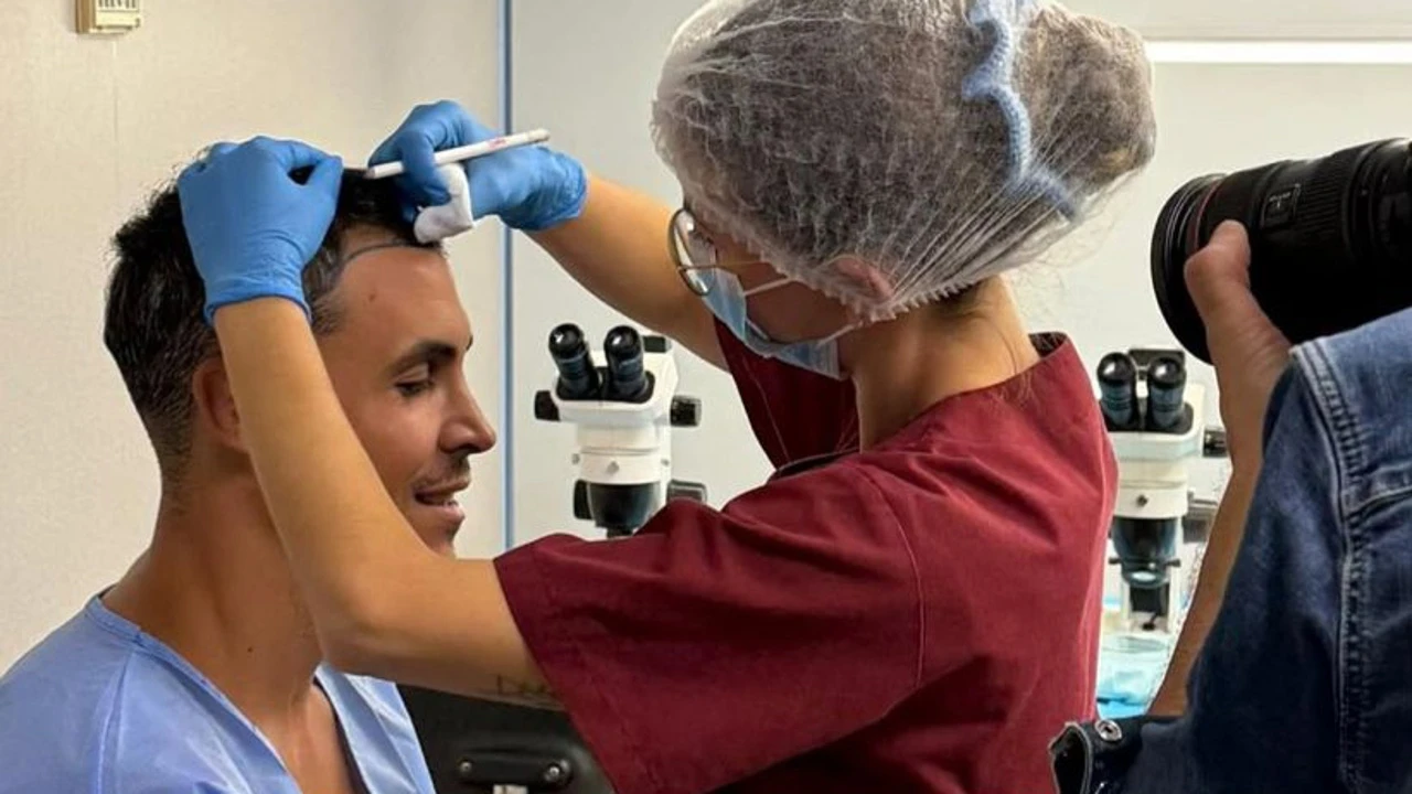 Kiko Jiménez se somete a un injerto capilar: primeras fotos de su intervención