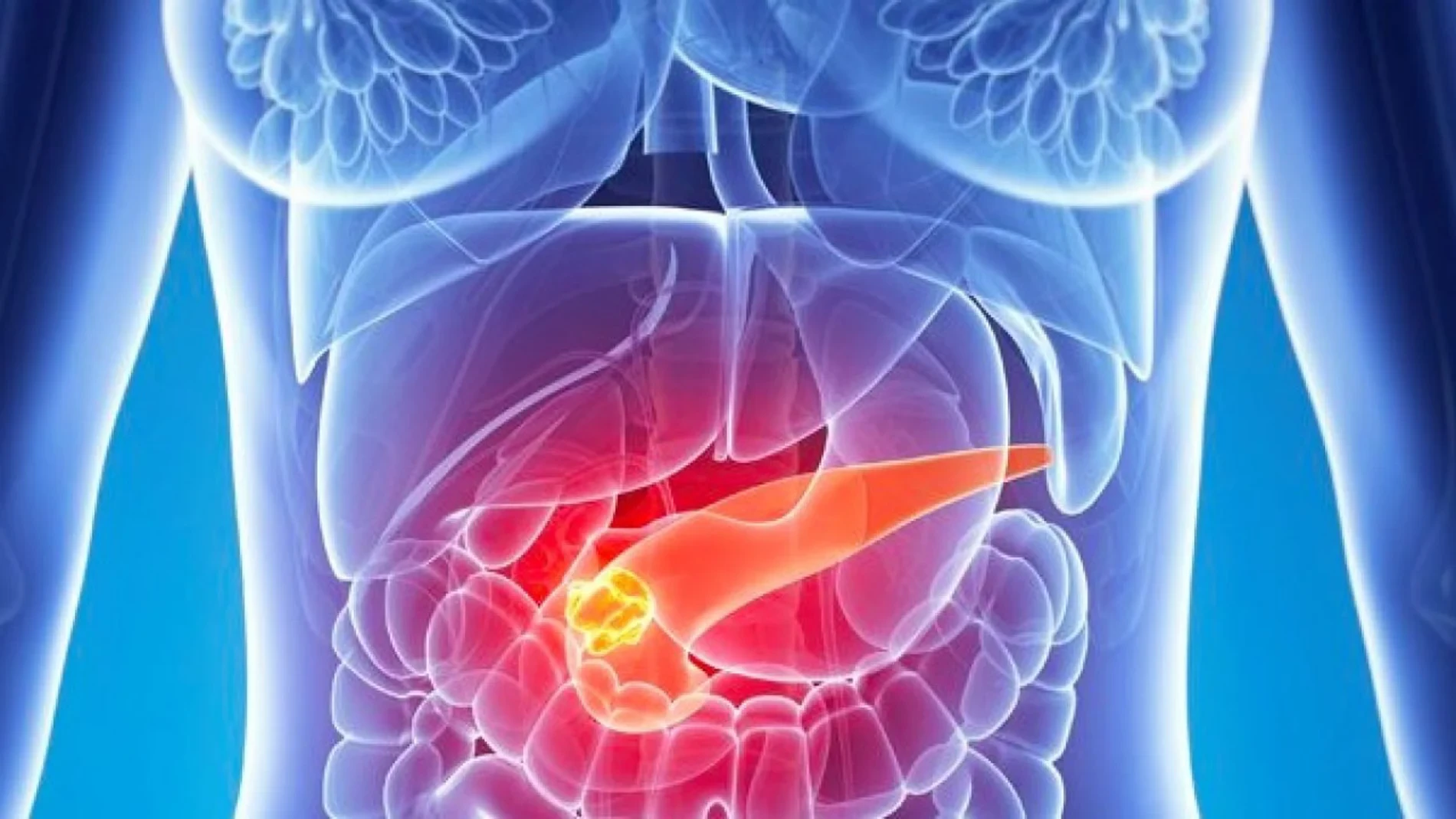 Investigadores españoles logran detectar el cáncer de páncreas en minutos