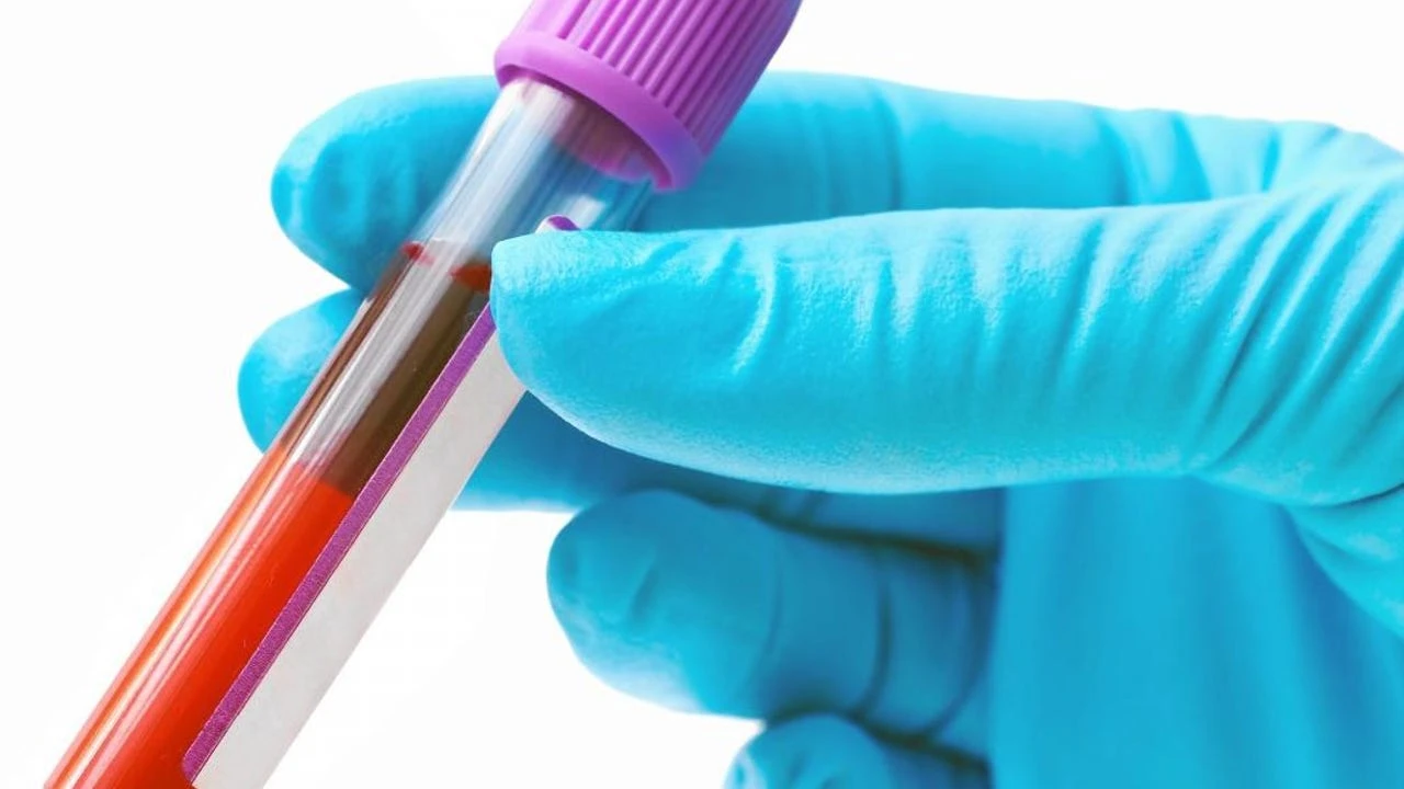 Un innovador test sanguíneo podría detectar la esclerosis múltiple antes de que se produzcan daños neurológicos