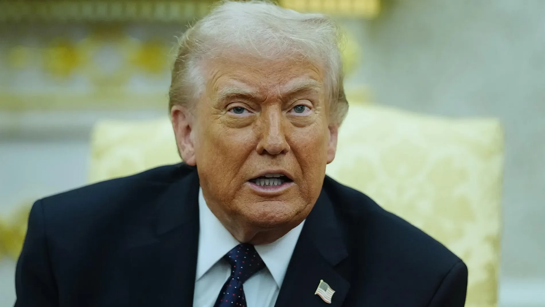 El nuevo examen médico de Donald Trump aclara el origen de los moretones en sus manos: “Un efecto benigno del uso de aspirina”