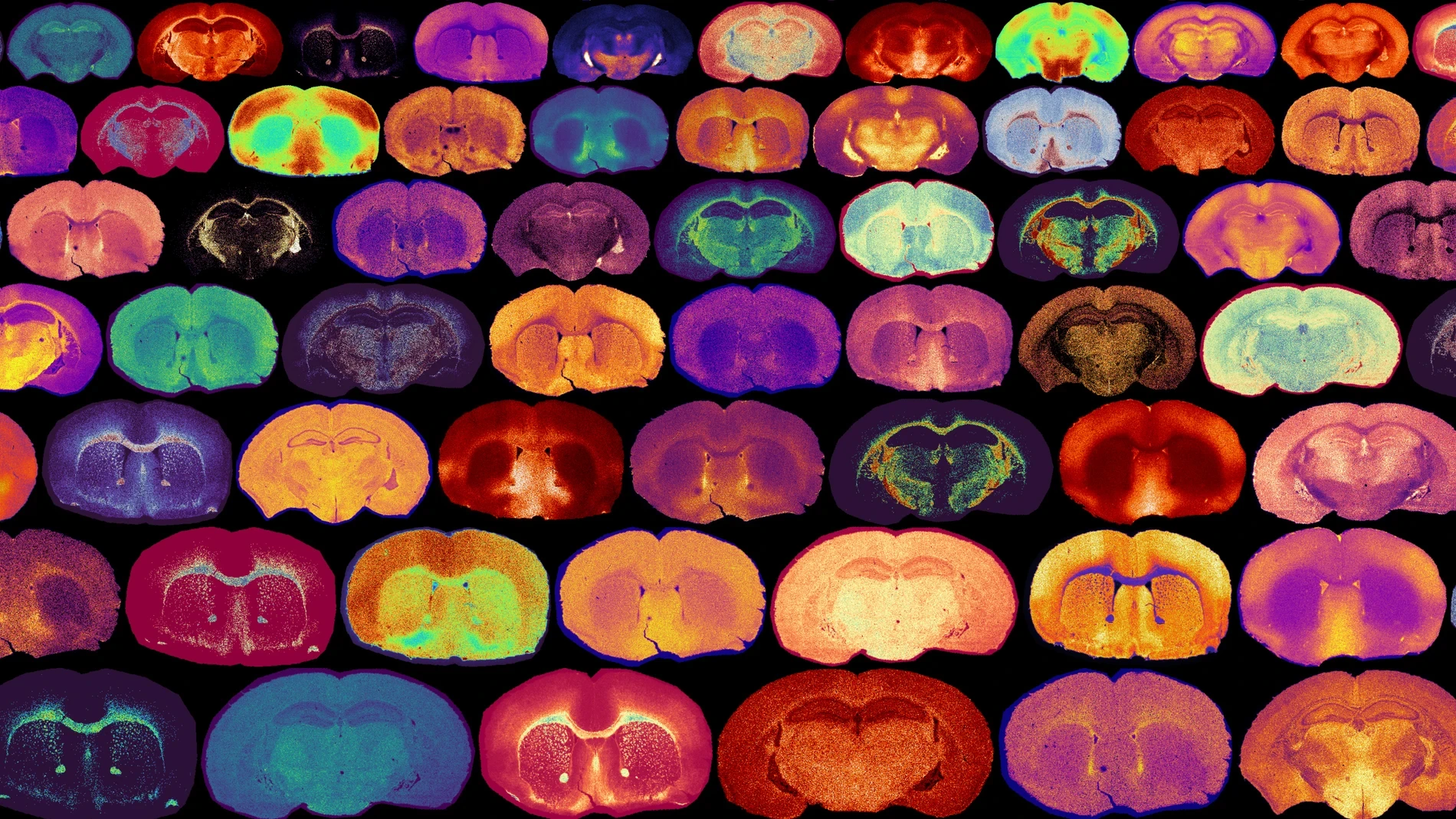El antojo por el azúcar en la infancia tendría un motivo: el desarrollo cerebral