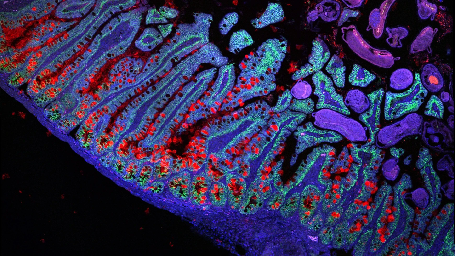 Harvard halla una pista clave en cáncer colorrectal: el intestino tiene 'memoria' y se acuerda de lo que comemos