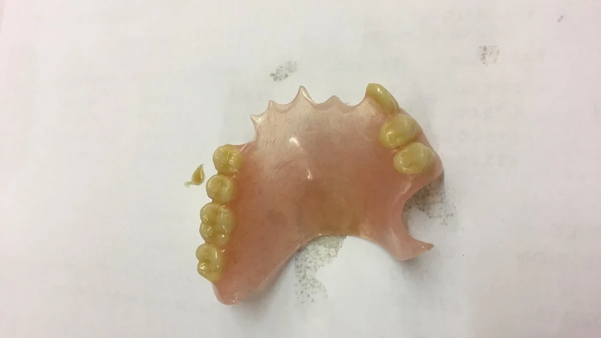 La Asociación Española de Endodoncia denuncia los peligros de la “odontología biológica” que promueve extracciones innecesarias ante el Consejo de Dentistas