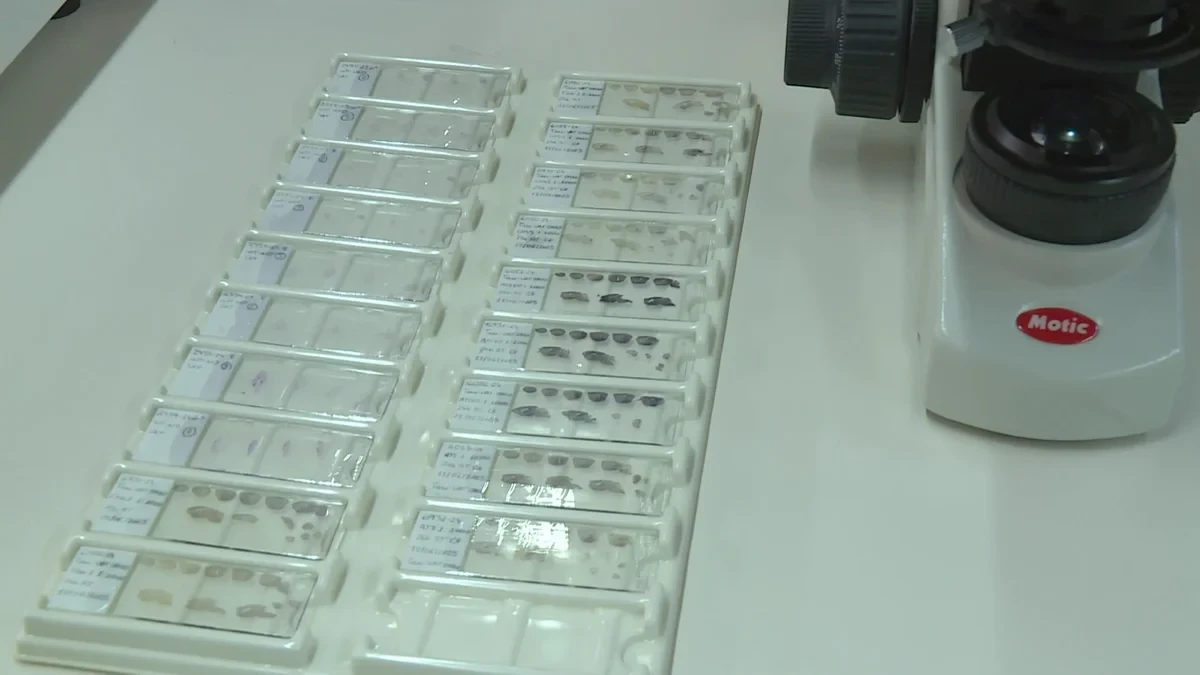 Gran avance en la lucha contra el alzhéimer: Investigadores españoles y chinos logran revertir la enfermedad con nanotecnología