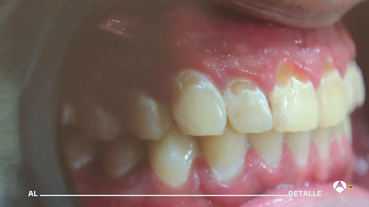Los dentistas alertan de los efectos de vapear en la salud bucodental