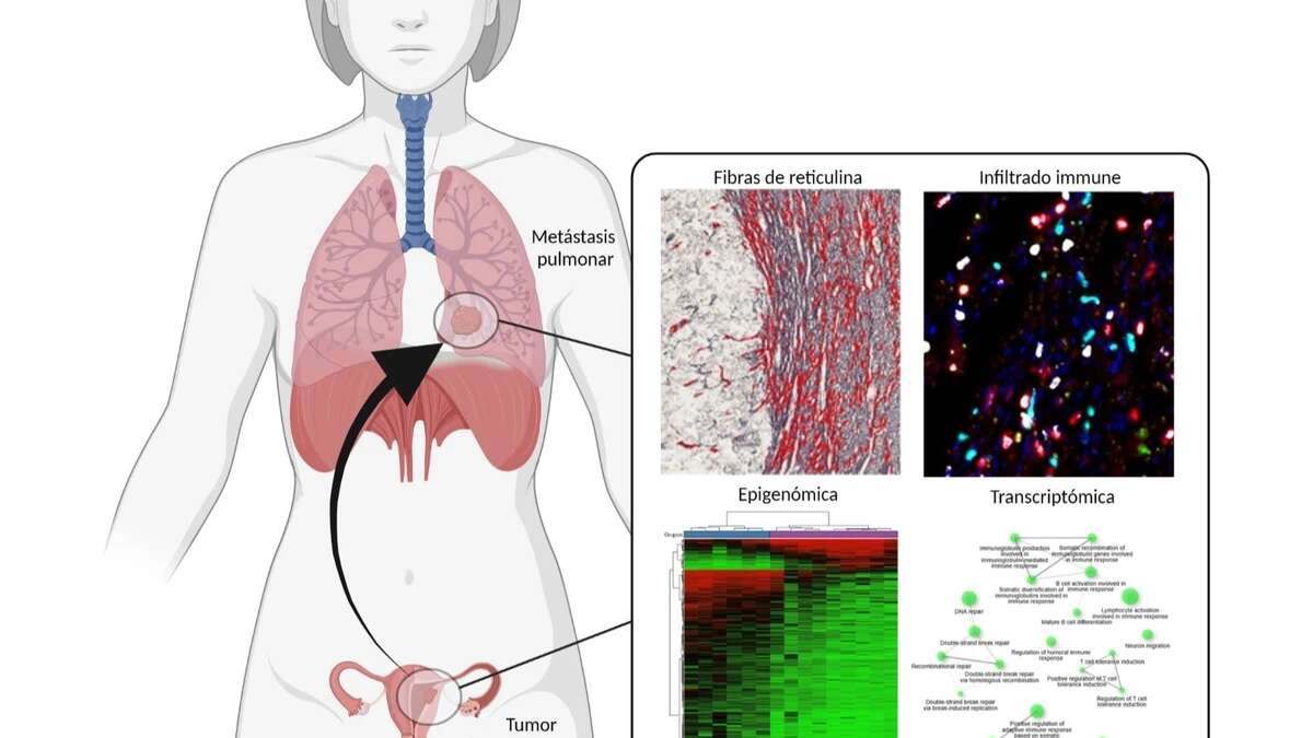 Cáncer de cuello uterino: qué es y qué síntomas no debes ignorar