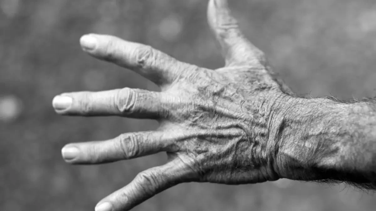Esperanza para el párkinson: un paciente recupera su vida normal tras una compleja cirugía cerebral en Barcelona