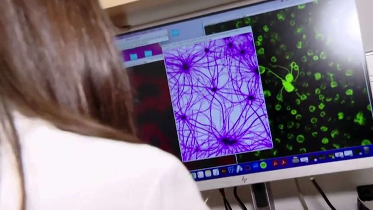 El autismo camina hacia una posible curación tras descubrir una proteína clave