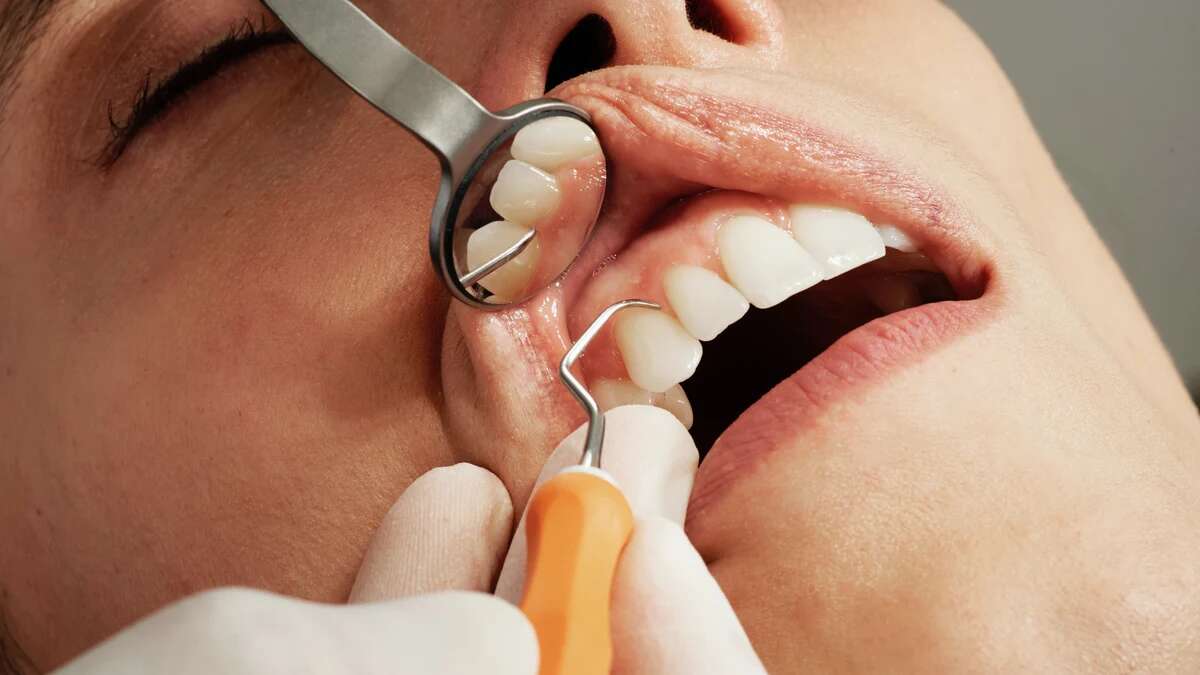 Condenado un dentista por extraer un diente equivocado en Tarragona