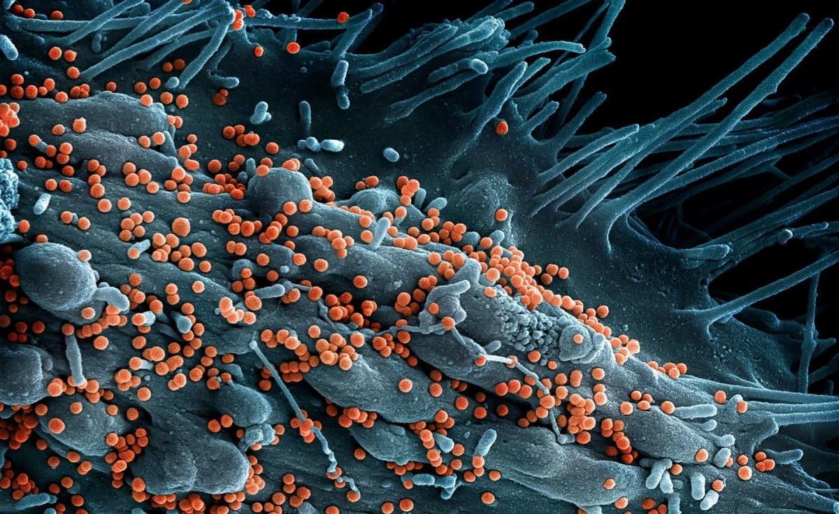 Nigeria Lassa Fever Death Toll Rises to 191