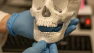 У Чехії розробляють технологію 3D-друку кісток