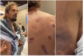 “Molestie e stupri in Israele, 15 casi nella Flotilla”. Un italiano fra i 50 attivisti ricoverati a Istanbul