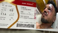 Incidente Air India, l’unico sopravvissuto era seduto davanti: si riapre il dibattito sui posti più sicuri in caso di schianto