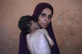 Se muore l’umanità, la fame fa strage di innocenti a Gaza: denutrito un bambino su tre, sabbia e calce per sopire il senso di fame