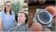 Neuralink, il primo video su YouTube realizzato col pensiero da un malato di Sla