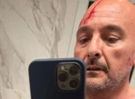 Caso Sangiuliano-Boccia, il giallo del tentato omicidio