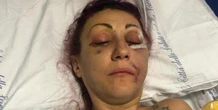 Pestò a sangue l’ex moglie. Impugnata l’assoluzione. I pm: linguaggio scorretto