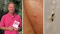 Formiche con il pungiglione, nuova invasione. L’entomologo: “Punto anch’io, come avere il fuoco addosso”