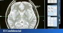 Predecir si tendrás alzhéimer es más fiable y barato que nunca. ¿Merece la pena saberlo?