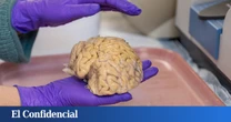 Encuentran un interruptor para recuperar la memoria perdida escondido en el cerebro