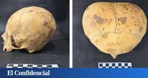 Perforan la vía pública y encuentran este cráneo: no es un 'alien', sino el resultado de una práctica macabra
