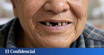 ¿Adiós a los implantes? El fármaco que regenera los dientes perdidos ya se prueba en humanos