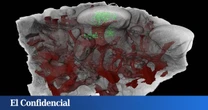Peces con 460M de años le dicen a la ciencia que tienen la culpa de tu sensibilidad dental