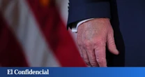 Trump frena las especulaciones sobre su salud y achaca los moratones a una "insuficiencia venosa"