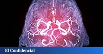 Estudian el cerebro humano y descubren por qué recuerdas cosas irrelevantes y te olvidas de lo importante