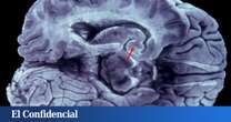 Estudian el cerebro y encuentran la explicación a por qué las mujeres viven más (y mejor)