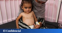 Para cuando Occidente pide camiones, ya es tarde: así destruye el hambre los cuerpos en Gaza