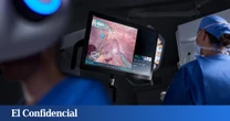 La cirugía se transforma: esta tecnología robótica ha hecho más de 170.000 operaciones en España