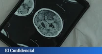 Estudian el cerebro humano y descubren a qué edad alcanza su máximo rendimiento